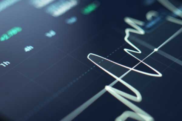 【好文重读】全球热潮！投资港股半导体芯片，终于有了高纯的ETF新品．．．